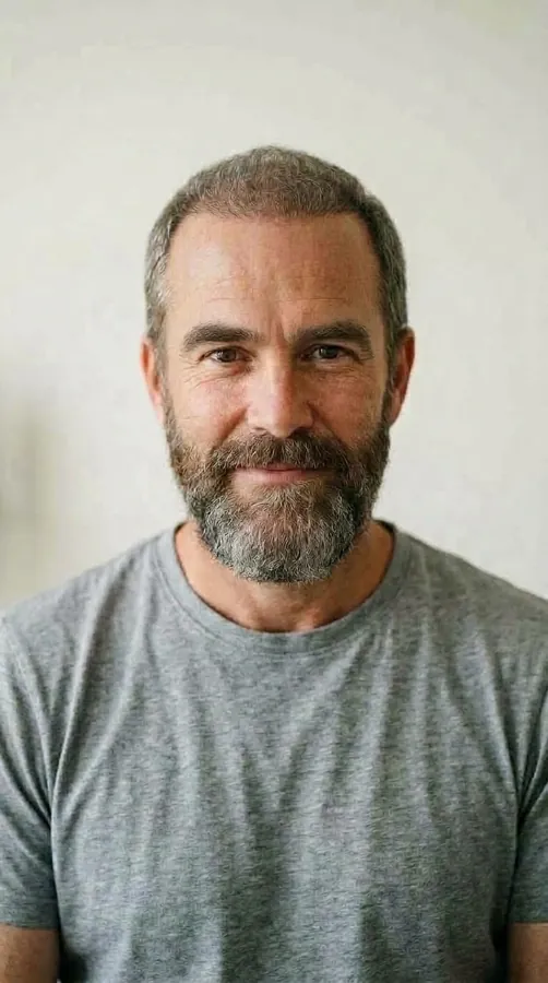 Simulación ilustrativa: el mismo hombre ficticio con cabello, barba y cejas restaurados en una sola imagen.